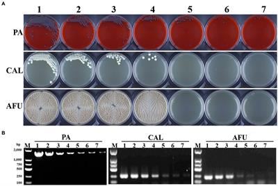 Methodological comparison of bronchoalveolar lavage fluid-based detection of respiratory pathogens in diagnosis of bacterium/fungus-associated pneumonia in critically ill patients